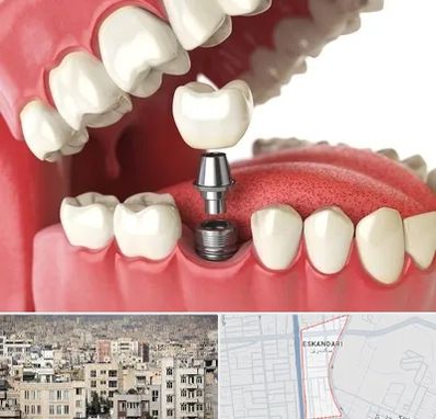 متخصص پروتز دندان در اسکندری