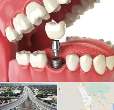 متخصص پروتز دندان در اندیمشک