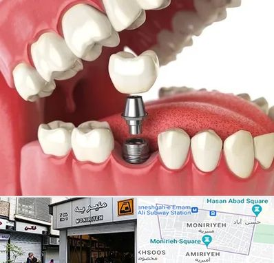 متخصص پروتز دندان در منیریه