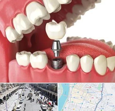 متخصص پروتز دندان در نادری اهواز