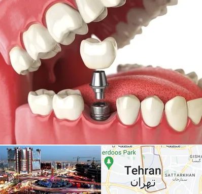 متخصص پروتز دندان در صادقیه