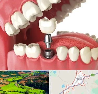 متخصص پروتز دندان در نکا