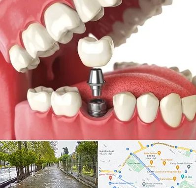 متخصص پروتز دندان در خیابان ارم شیراز