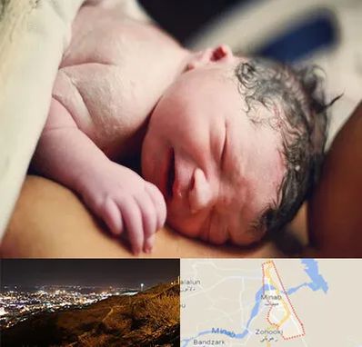 زایمان فیزیولوژیک در میناب