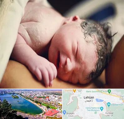 زایمان فیزیولوژیک در لاهیجان