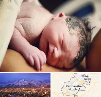 زایمان فیزیولوژیک در کرمانشاه