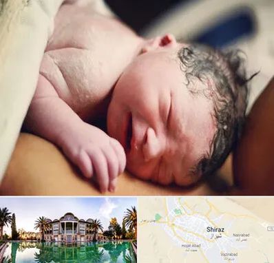 زایمان فیزیولوژیک در شیراز