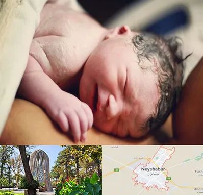 زایمان فیزیولوژیک در نیشابور