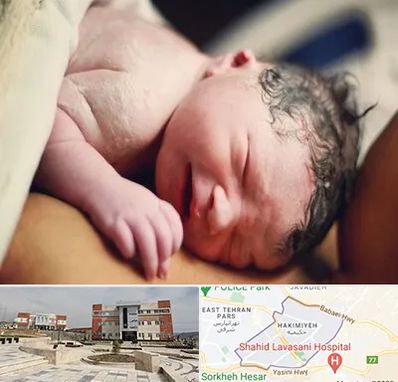 زایمان فیزیولوژیک در حکیمیه 