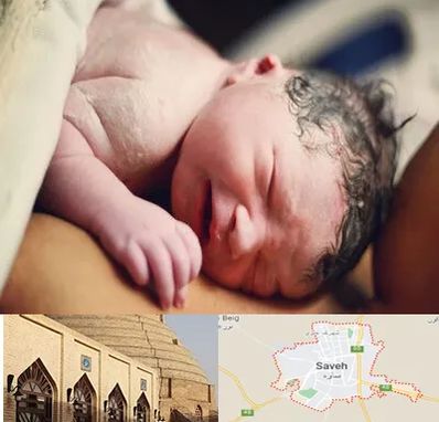 زایمان فیزیولوژیک در ساوه