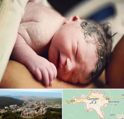 زایمان فیزیولوژیک در گرگان