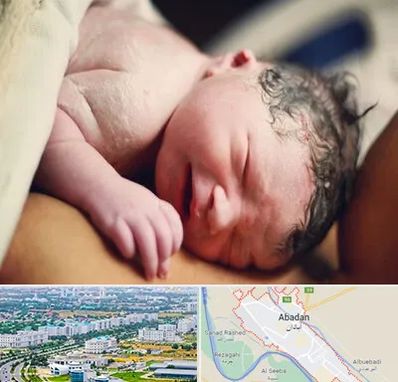 زایمان فیزیولوژیک در آبادان