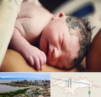زایمان فیزیولوژیک در بندر ترکمن