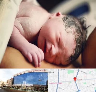 زایمان فیزیولوژیک در نصف راه تبریز