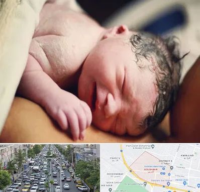 زایمان فیزیولوژیک در گلشهر کرج