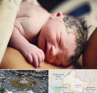 زایمان فیزیولوژیک در فردیس کرج 