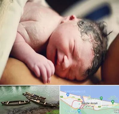 زایمان فیزیولوژیک در بندر انزلی