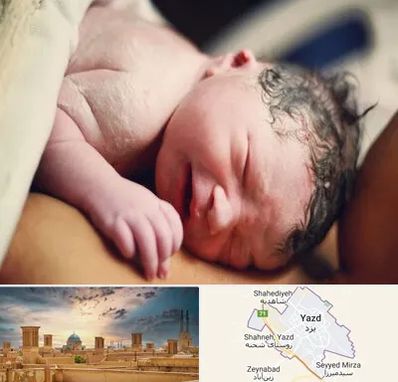 زایمان فیزیولوژیک در یزد