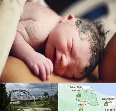 زایمان فیزیولوژیک در چالوس