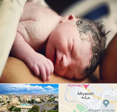 زایمان فیزیولوژیک در میانه