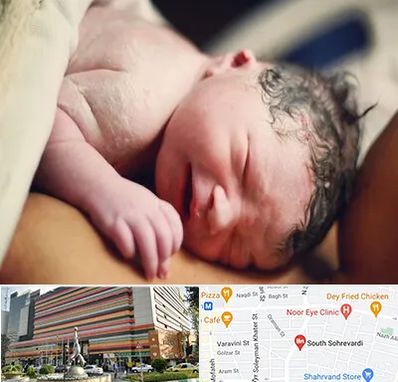 زایمان فیزیولوژیک در سهروردی 