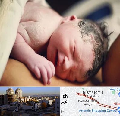 زایمان فیزیولوژیک در فرمانیه 