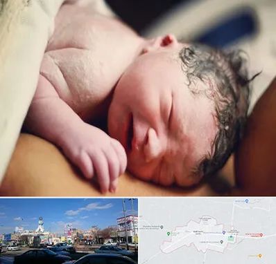 زایمان فیزیولوژیک در ماهدشت کرج