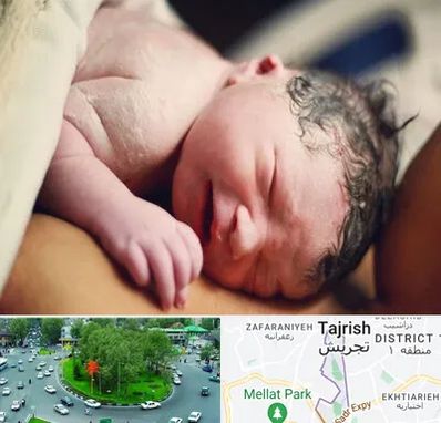 زایمان فیزیولوژیک در تجریش 