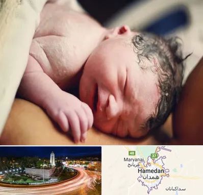 زایمان فیزیولوژیک در همدان