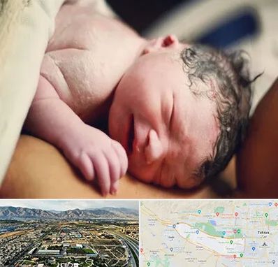 زایمان فیزیولوژیک در منطقه 21 تهران