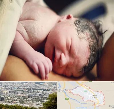 زایمان فیزیولوژیک در یاسوج