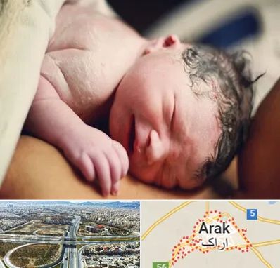 زایمان فیزیولوژیک در اراک