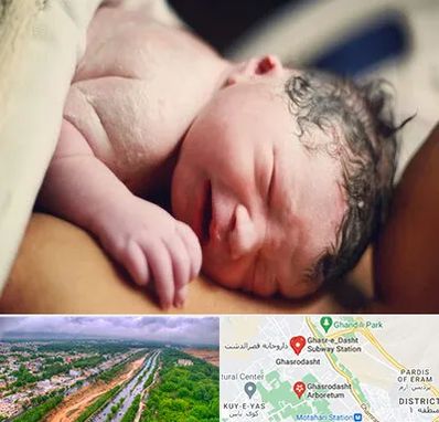 زایمان فیزیولوژیک در قصرالدشت شیراز