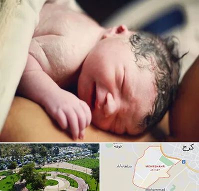 زایمان فیزیولوژیک در مهرشهر کرج 