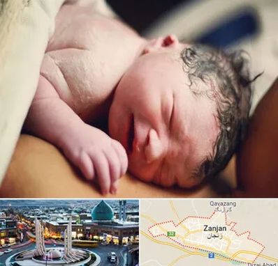 زایمان فیزیولوژیک در زنجان