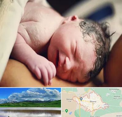 زایمان فیزیولوژیک در مرند