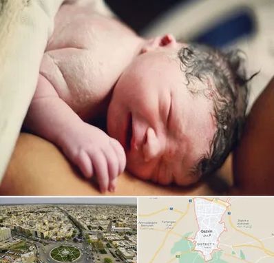 زایمان فیزیولوژیک در قزوین