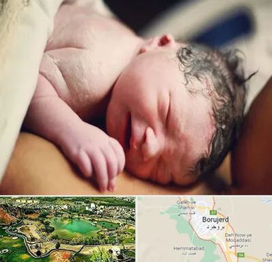 زایمان فیزیولوژیک در بروجرد