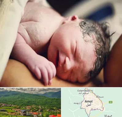 زایمان فیزیولوژیک در آمل