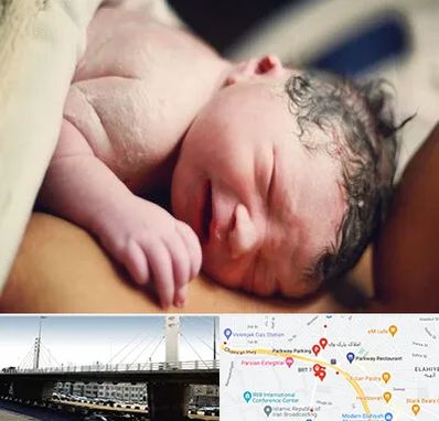 زایمان فیزیولوژیک در پارک وی 