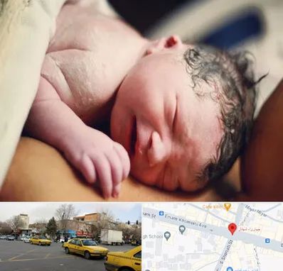 زایمان فیزیولوژیک در شهناز تبریز