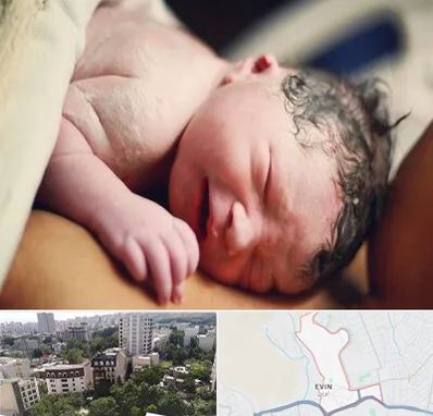 زایمان فیزیولوژیک در اوین