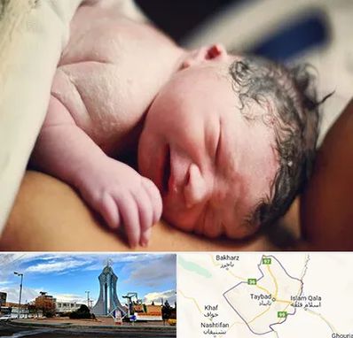 زایمان فیزیولوژیک در تایباد