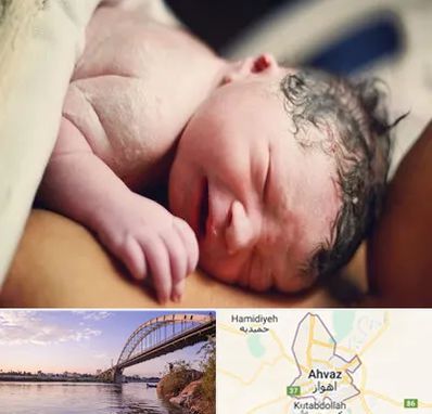 زایمان فیزیولوژیک در اهواز