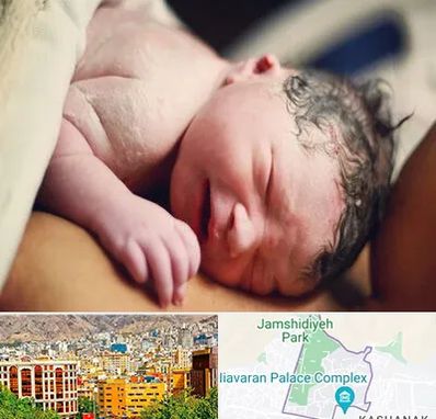 زایمان فیزیولوژیک در نیاوران 