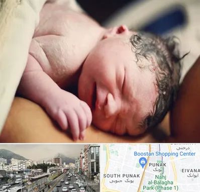 زایمان فیزیولوژیک در پونک 