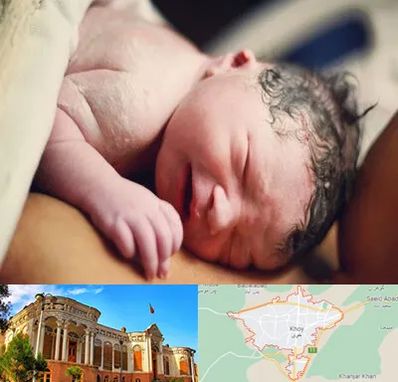 زایمان فیزیولوژیک در خوی