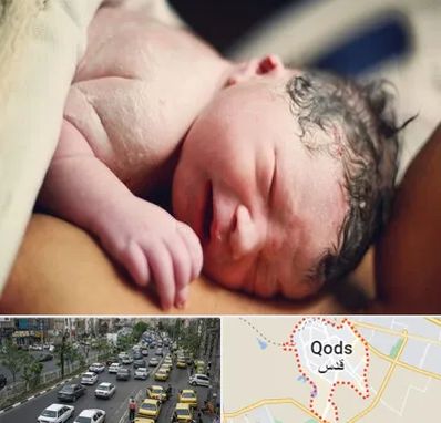 زایمان فیزیولوژیک در شهر قدس