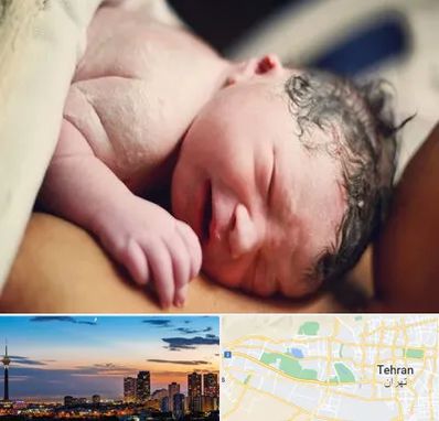 زایمان فیزیولوژیک در غرب تهران 