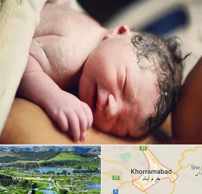 زایمان فیزیولوژیک در خرم آباد